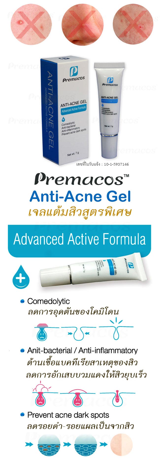 Premacos Anti-Acne Gel เจลแต้มสิว พรีม่าคอส สิวยุบเร็ว